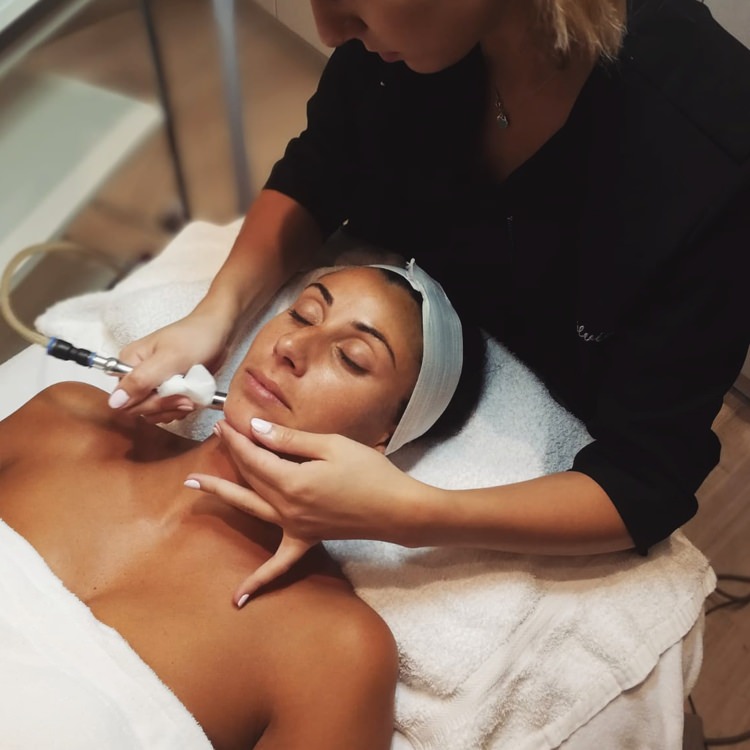 Microdermabrasion treatment example